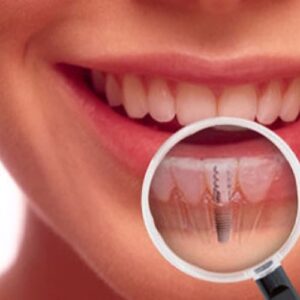 خدمات دندانپزشکی تهران