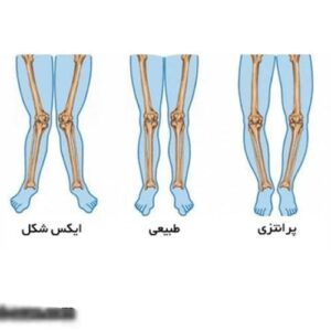 کلینیک سلامت پا در تهران